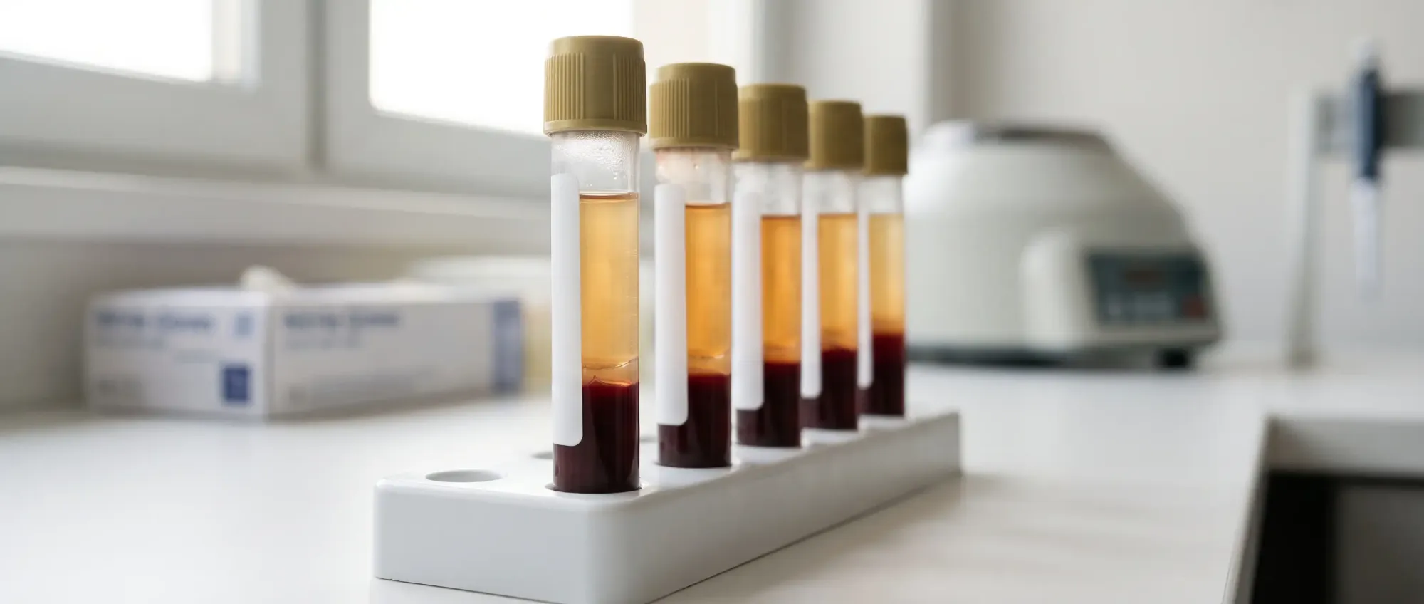 Centrifuged blood samples in a lab rack, with pale serum separated above the red cells
